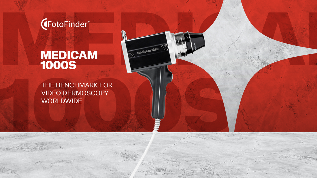 Enhancing Dermatology with the Medicam 1000s by FotoFinder: A Revolutionary Breakthrough